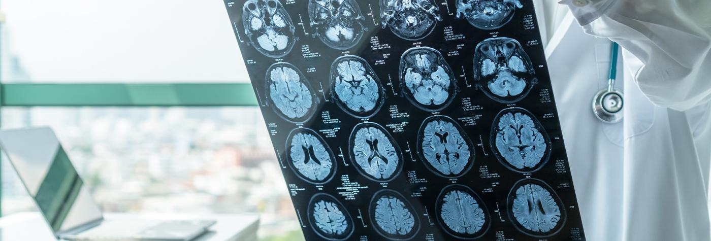 Neurology